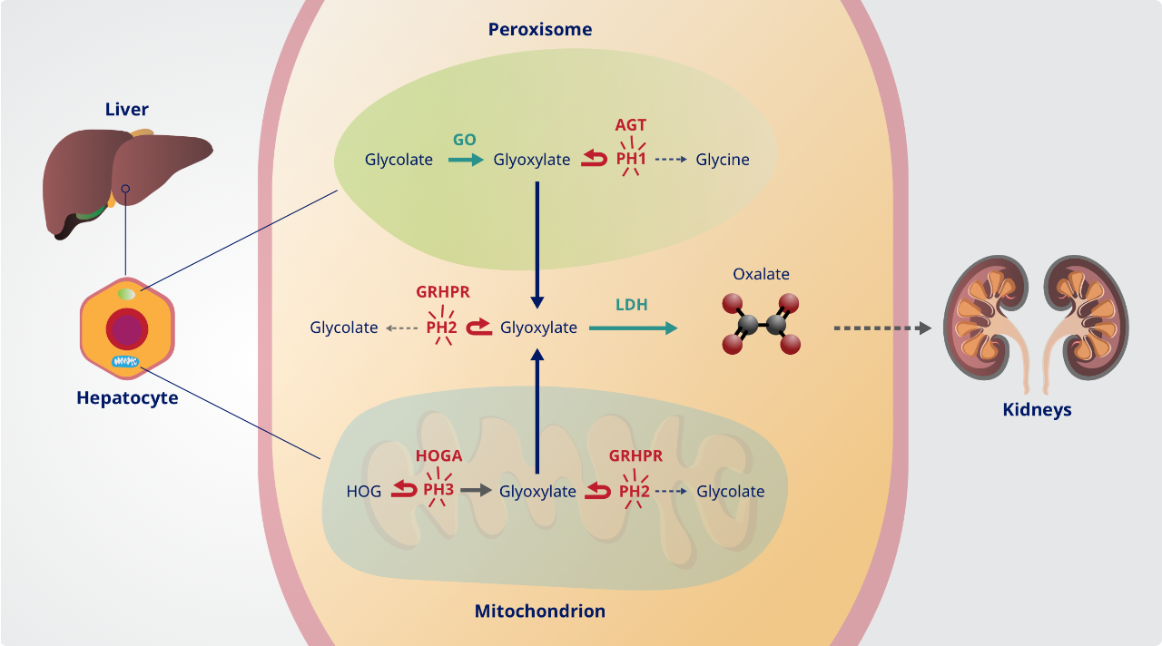 Dysregulated glyoxylate metabolic pathway graphic